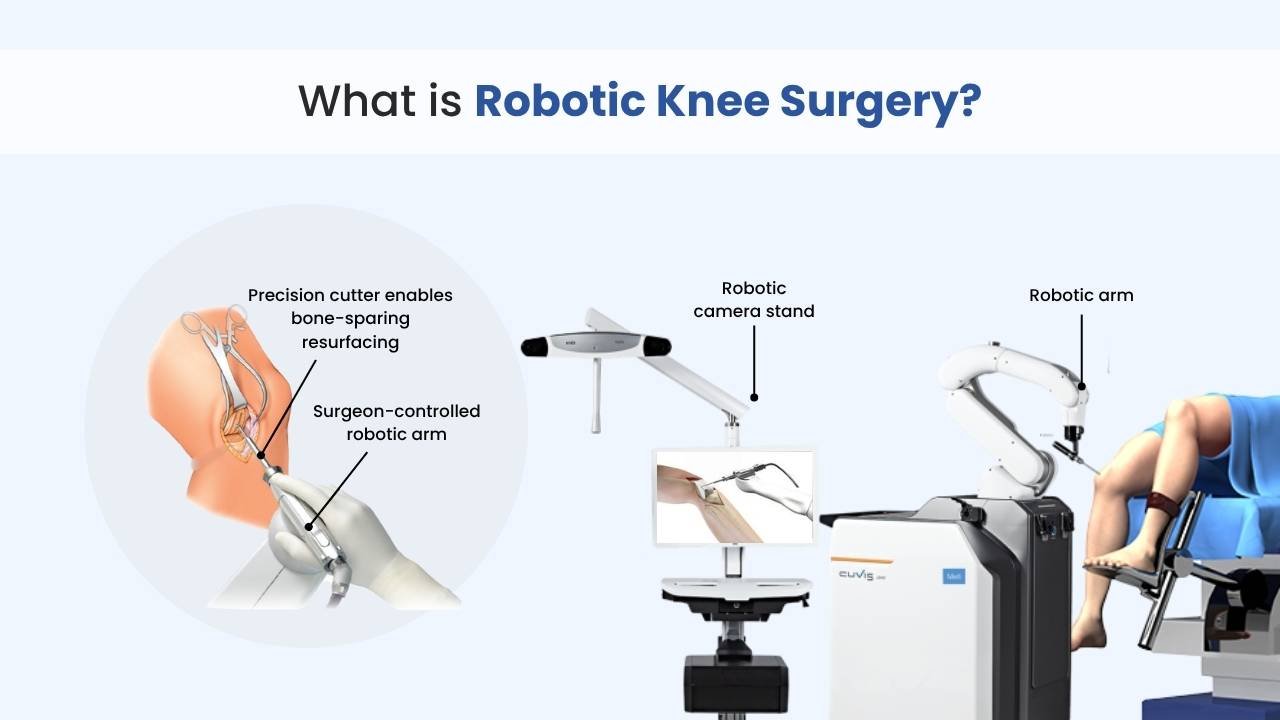 what is robotic knee surgery