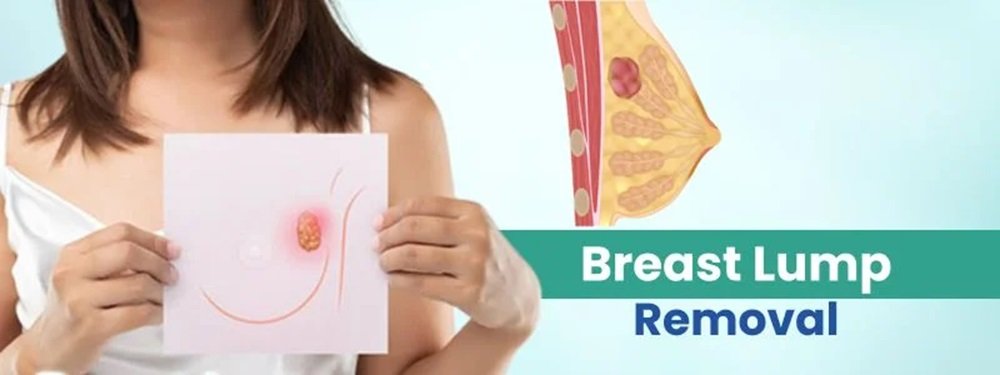breast lump removal cost in india