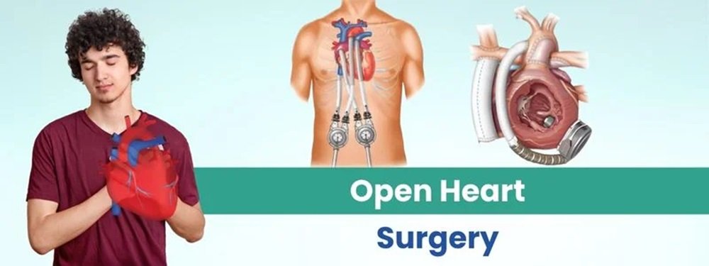 open heart surgery cost in india