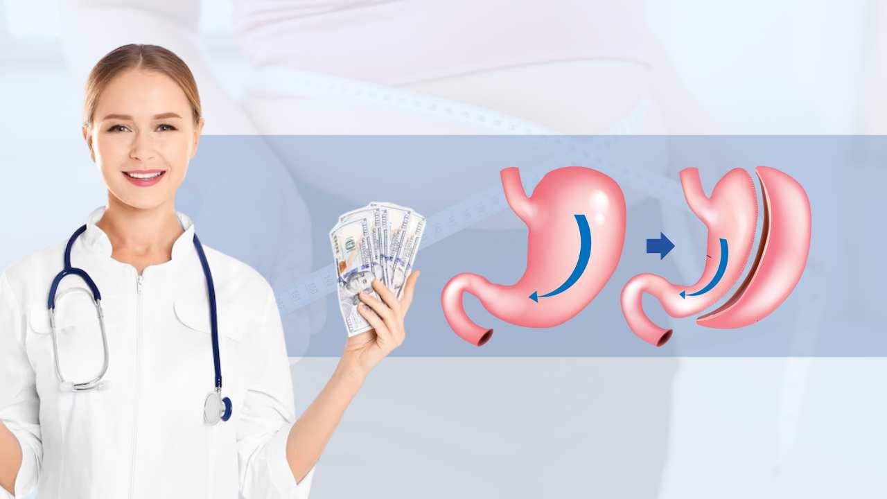 factors that may affect gastric sleeve surgery cost in india