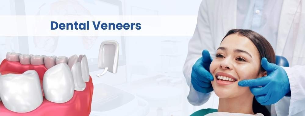 dental veneers cost in india