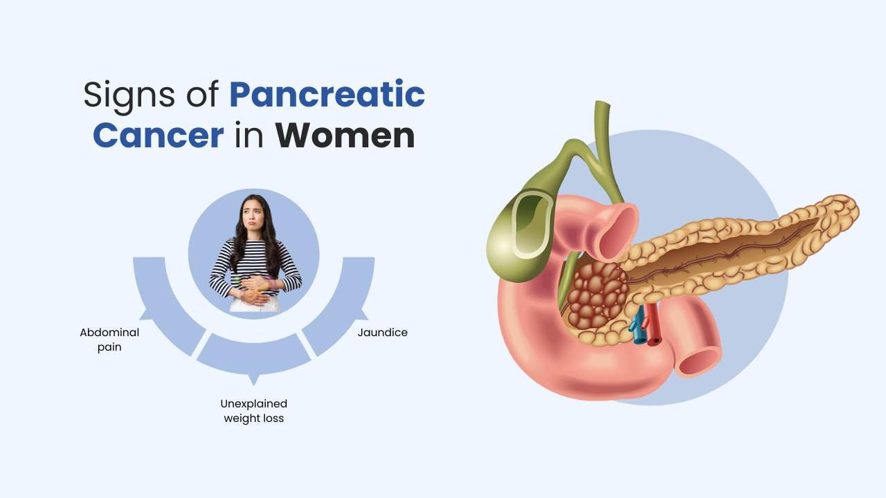signs of pancreatic cancer in women