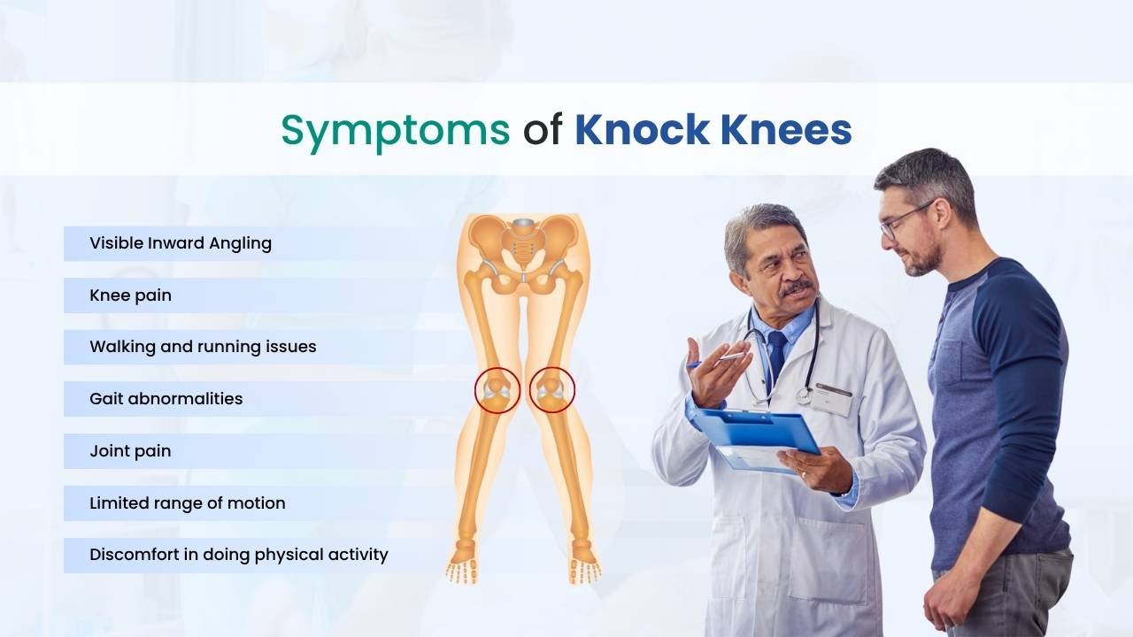symptoms of knock knee
