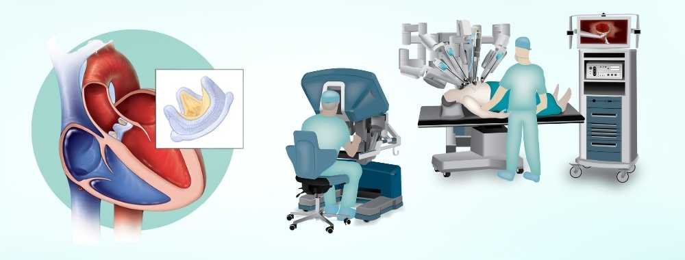 Technologies Used in Aortic Valve Replacement in India