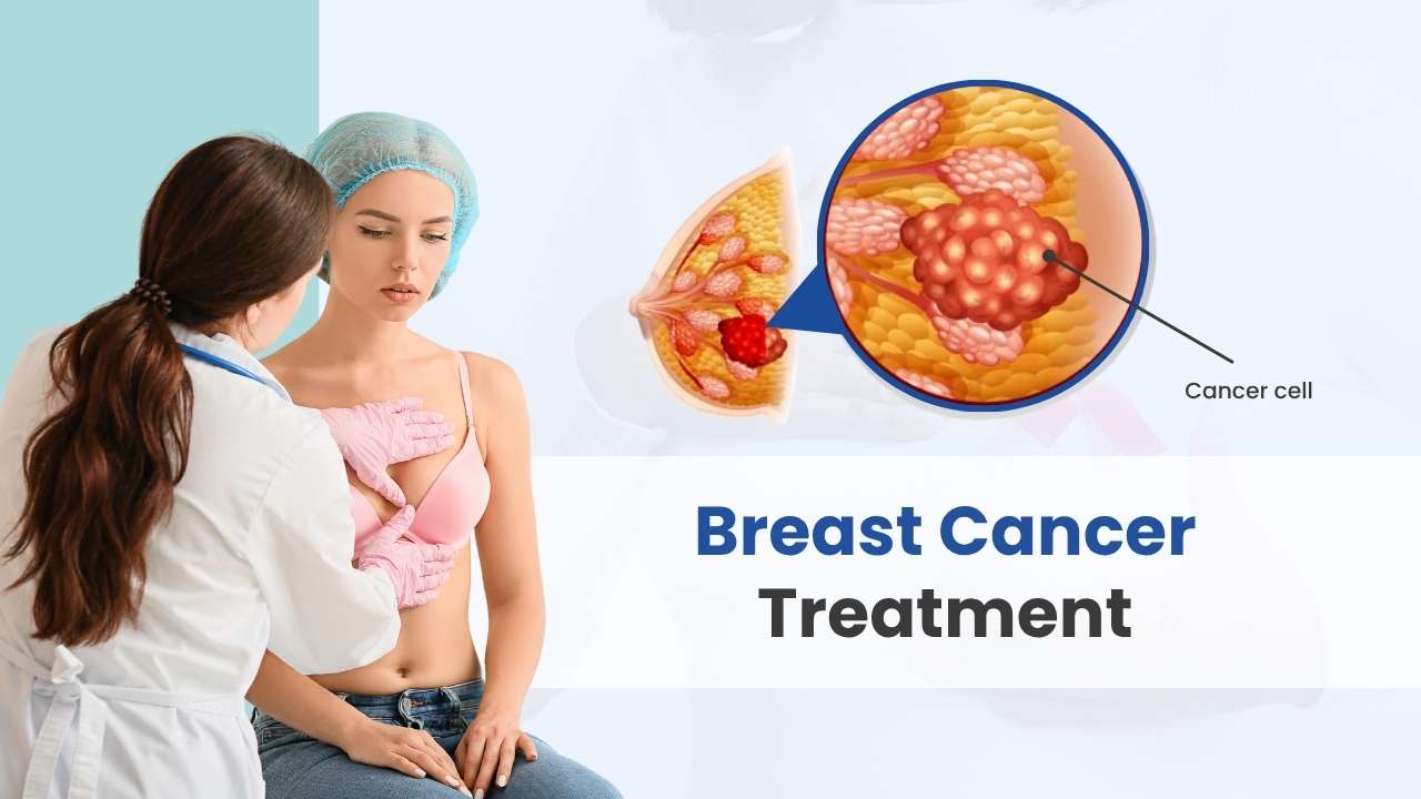 breast cancer treatment cost in india