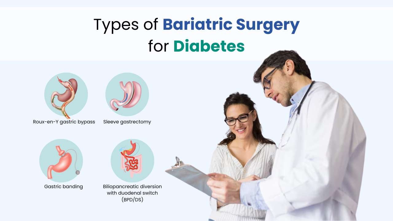 types of bariatric surgery for diabetes