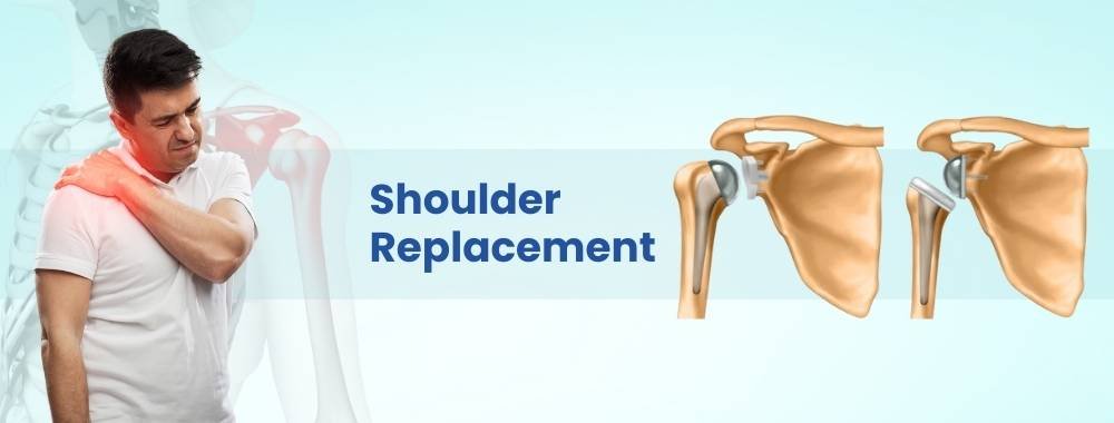 shoulder replacement cost in india