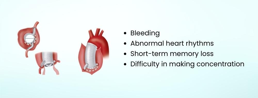 risk and complications of Bentall Procedure