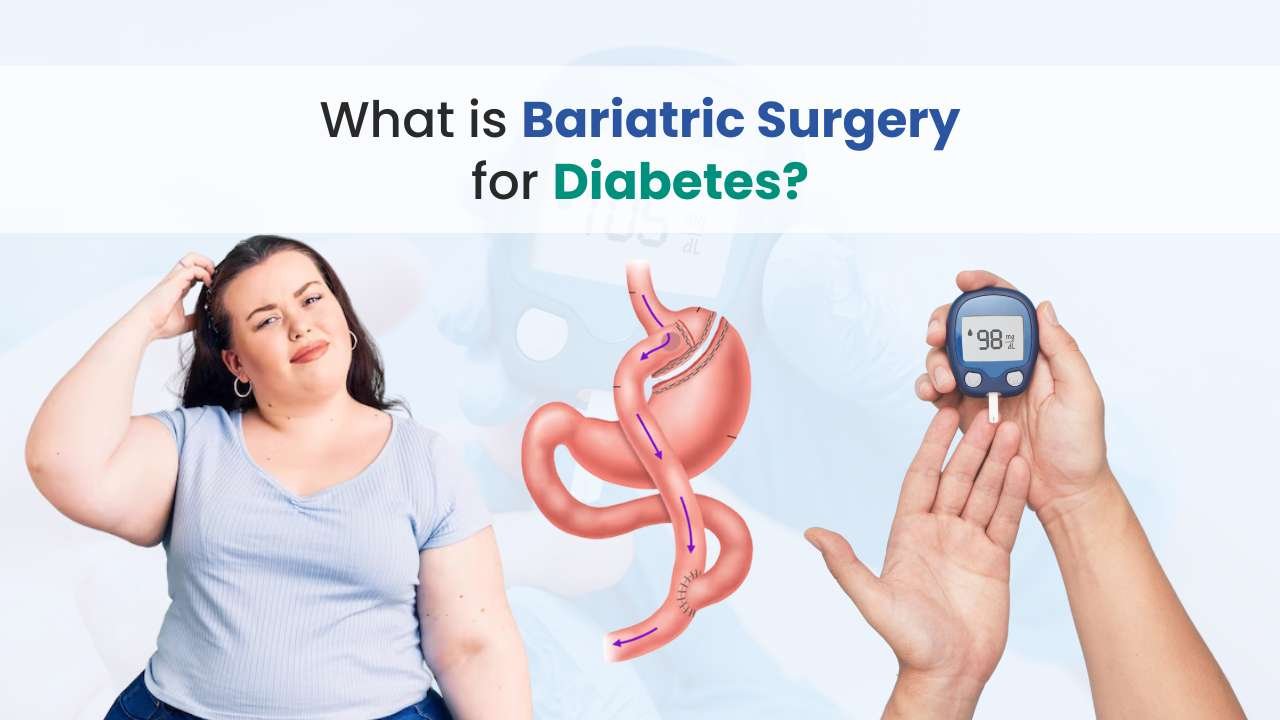 what is bariatric surgery for diabetes