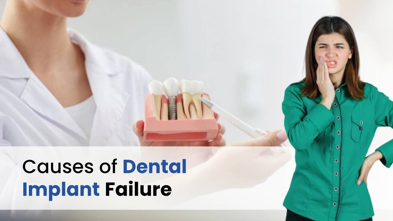 cause of dental implant