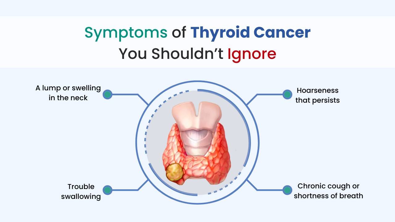 thyroid cancer symptoms you should not ignore