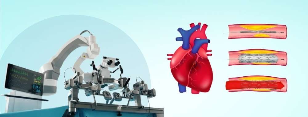 technologies used in india for angioplasty with one stent