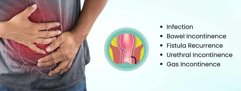 possible complications of fistula surgery