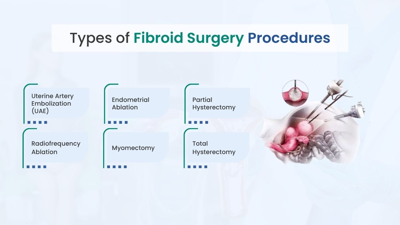 types of fibroid surgery