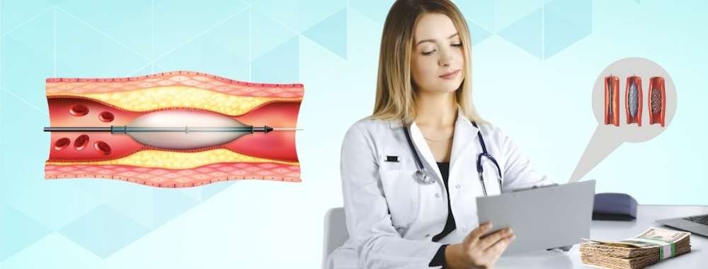 factors affecting angioplasty with one stent cost in india