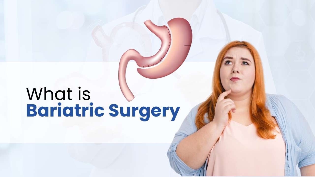 what is bariatric surgery