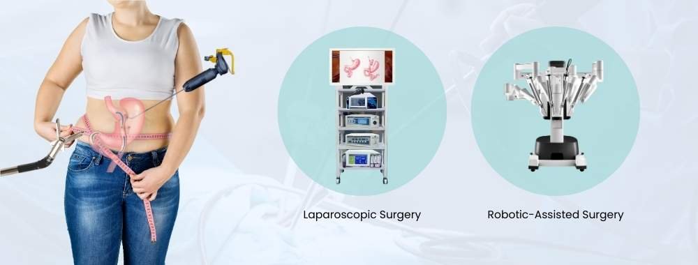 technology used in roux-en-y gastric bypass surgery in india