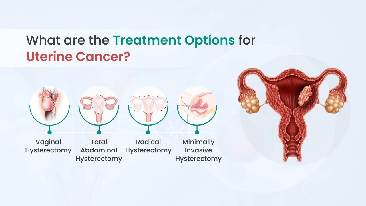 treatment options for uterine cancer