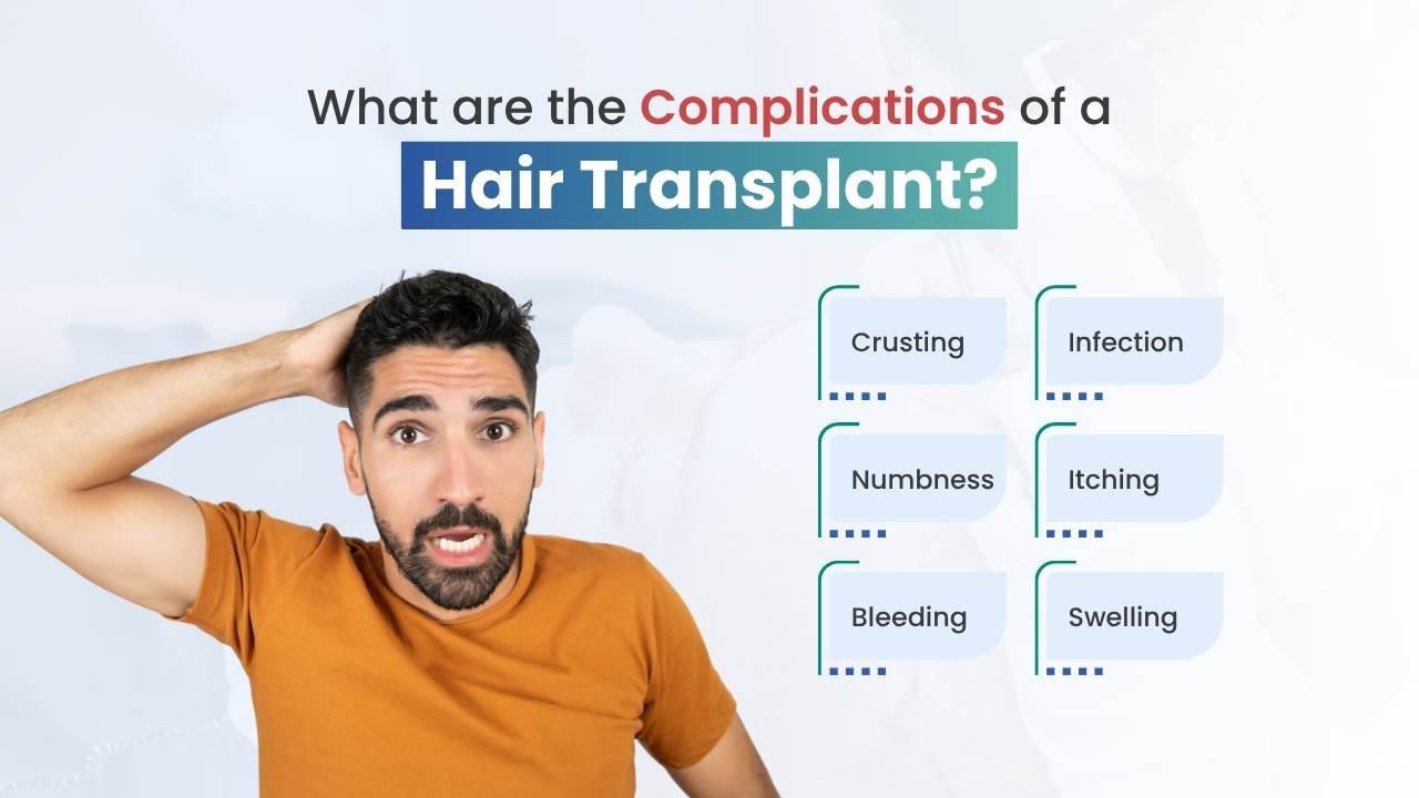 what are the complication of hair transplant