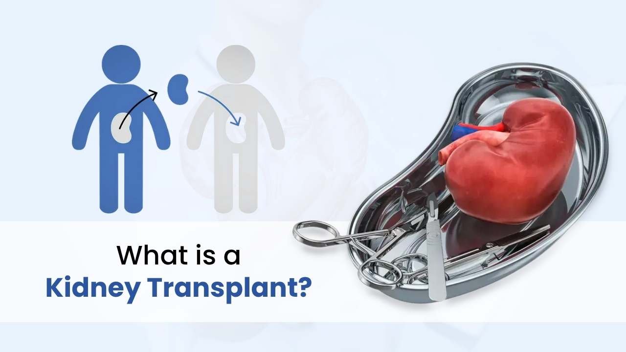 what is kidney trasnplant