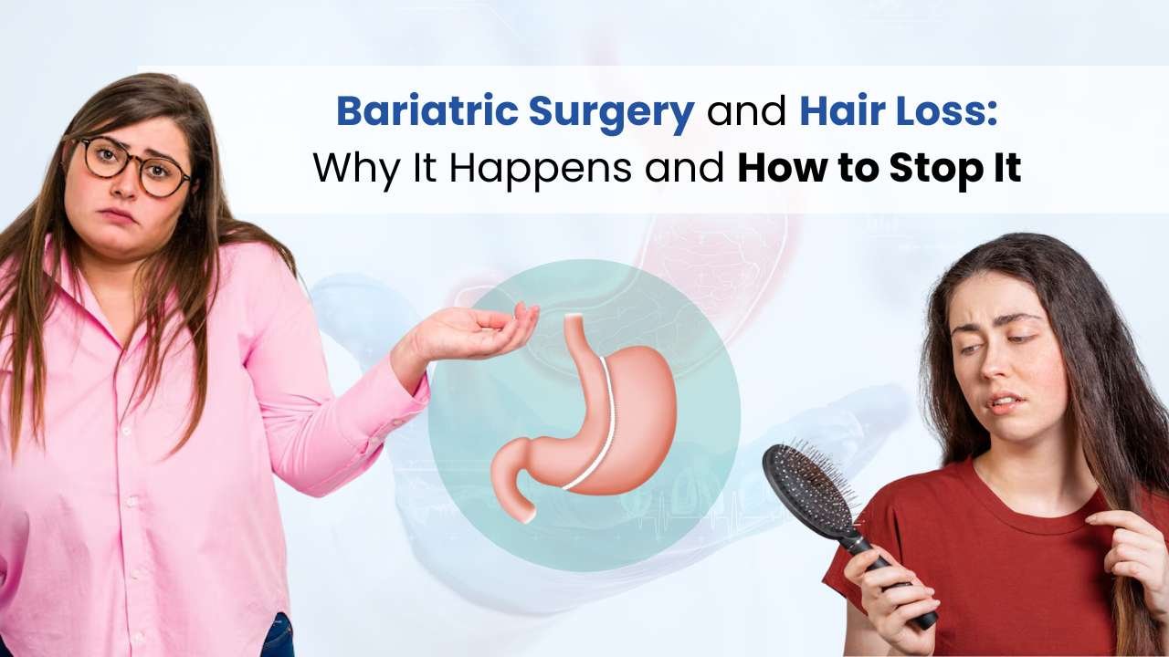 bariatric surgery and hair loss why it happens and how to stop it
