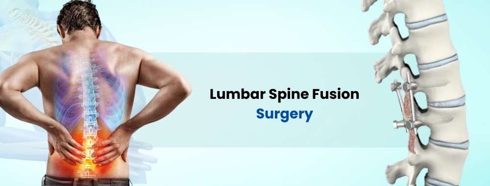lumbar spine fusion surgery cost in india