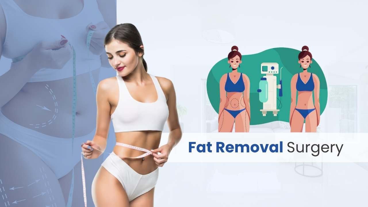 fat removal surgery