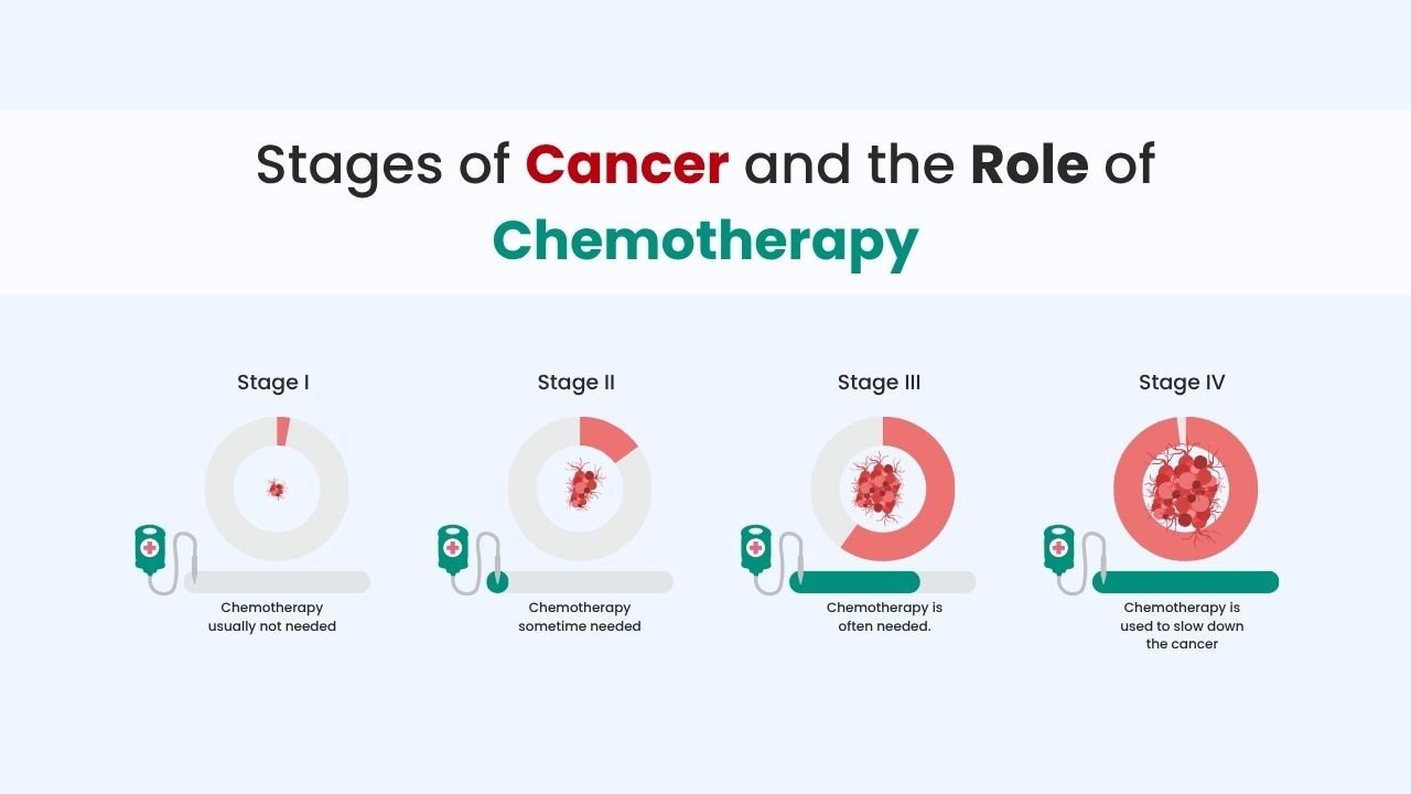 stages of cancer and the role of chemotherapy