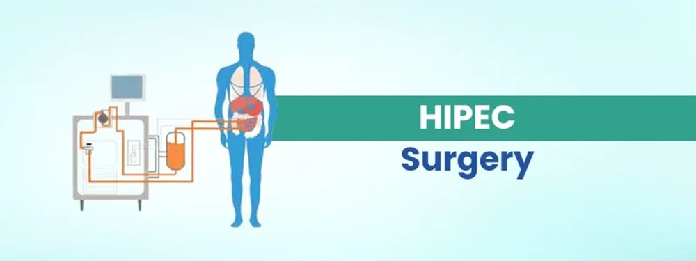 hipec surgery cost in india