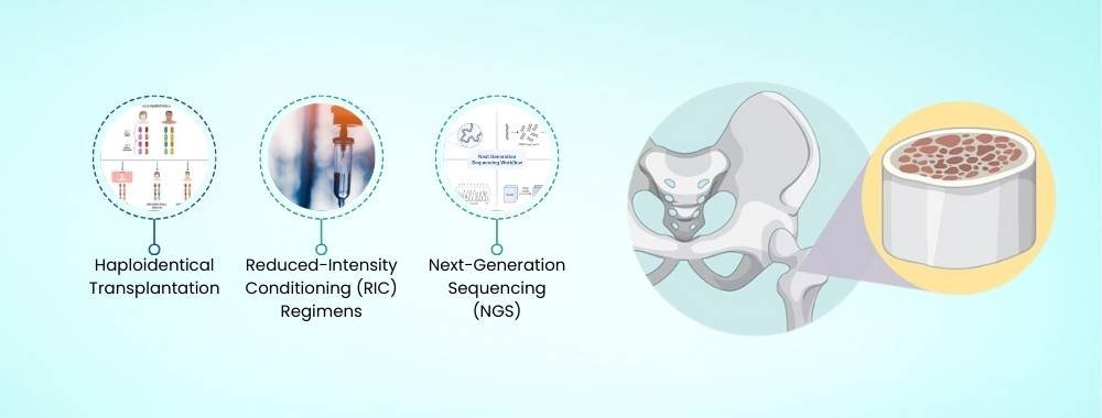 technologies used in india for pediatric bone marrow transplant