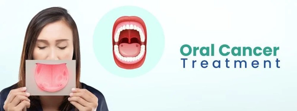 oral cancer treatment cost in india