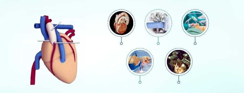technologies used in india for the bentall procedure