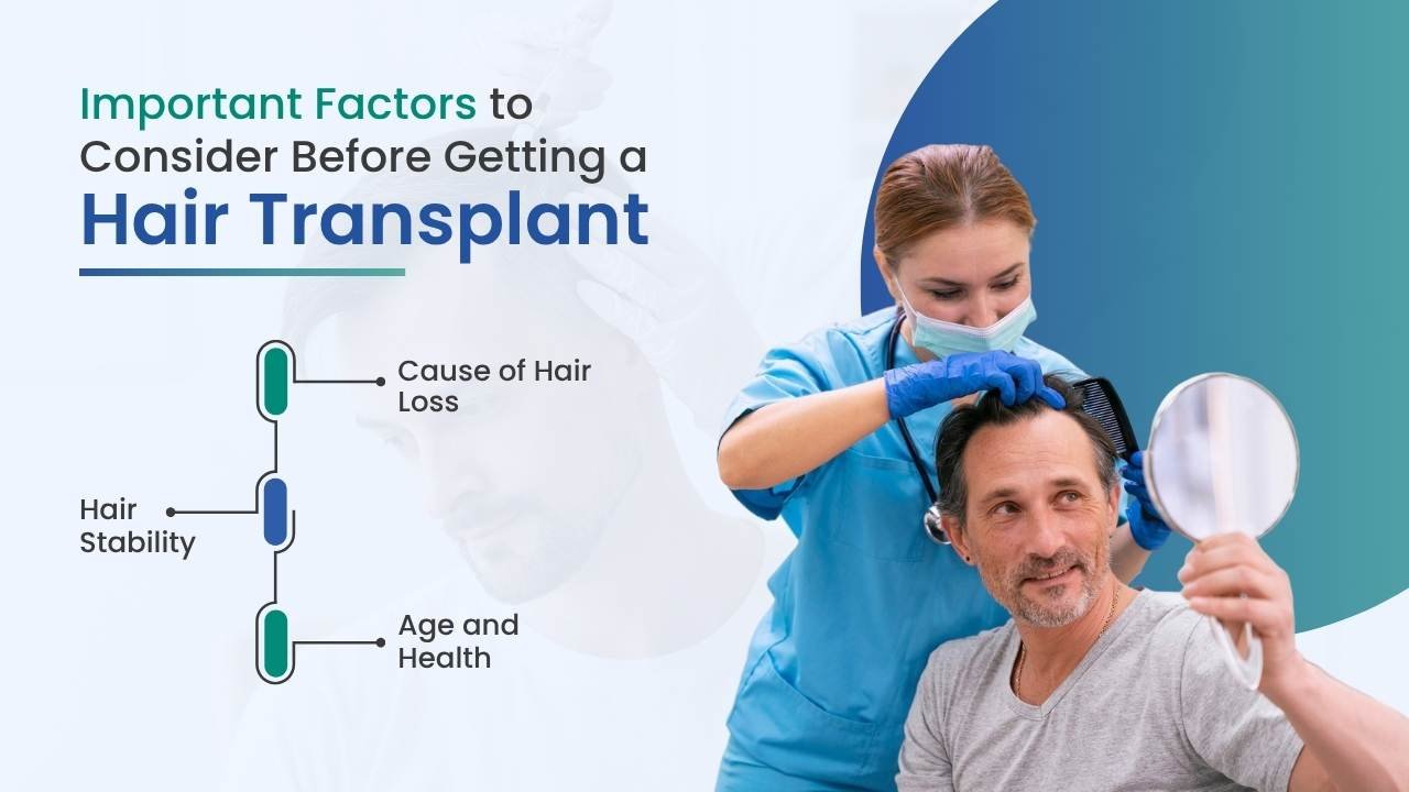 important factor to consider before getting a hair transplant