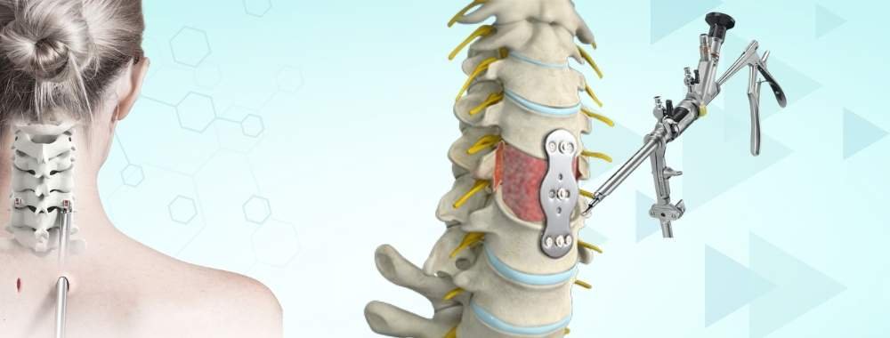 technologies used in india for anterior cervical discectomy and fusion