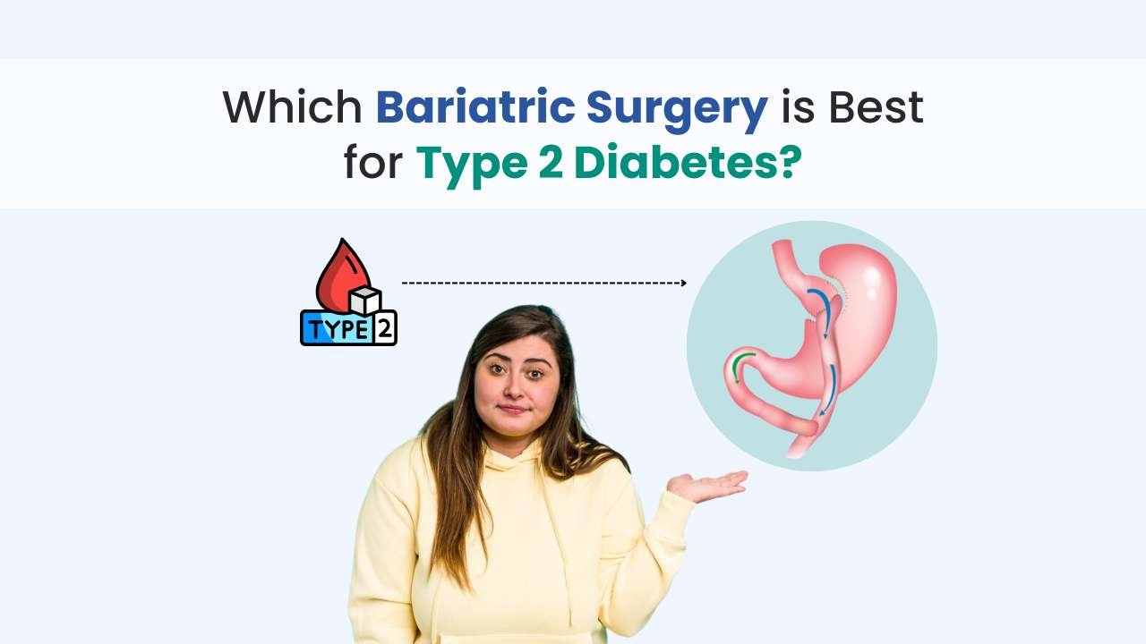 which bariatric surgery is best for type 2 diabetess