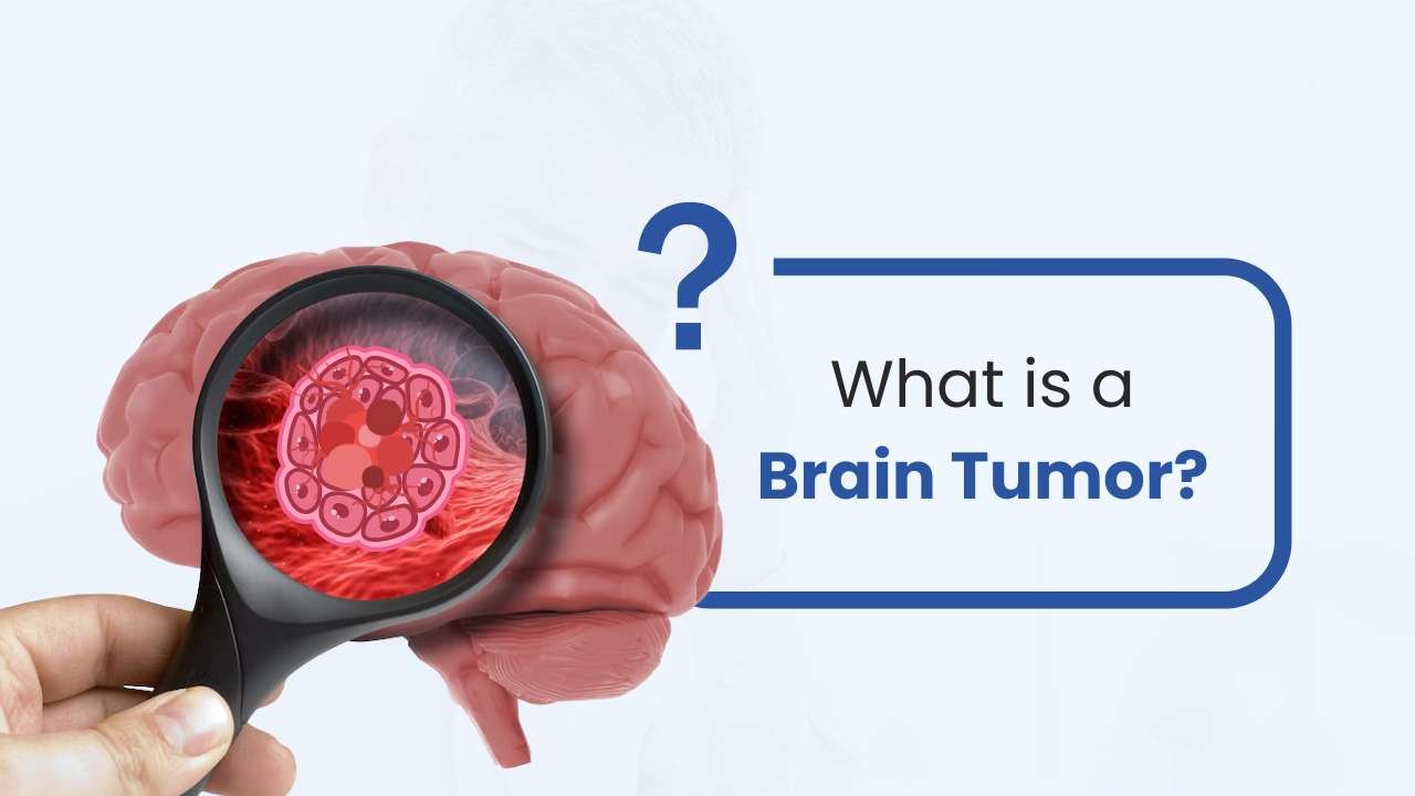 what is a brain tumor