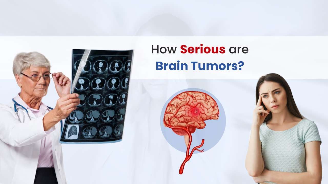 how serious are brain tumor
