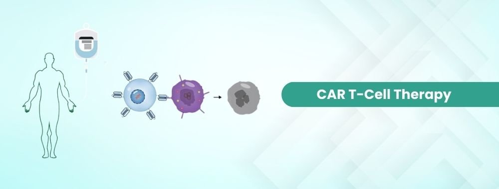 car t cell therapy cost in india