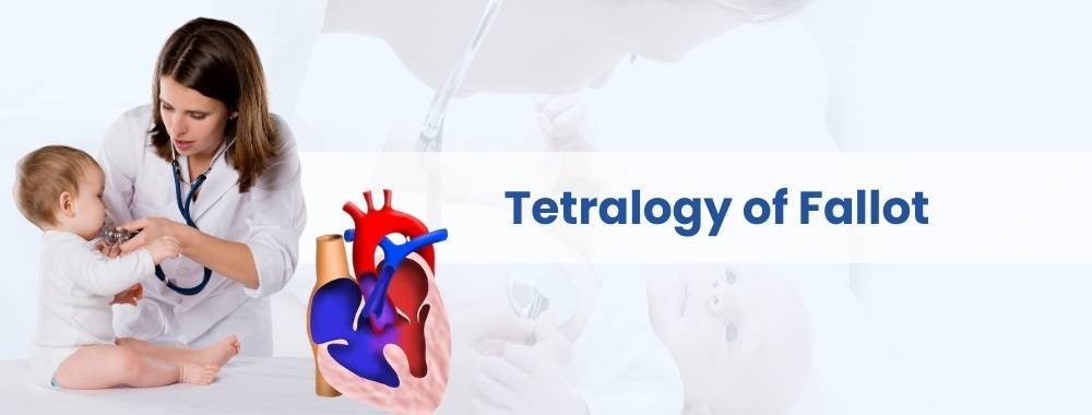 tetralogy of fallot cost in india