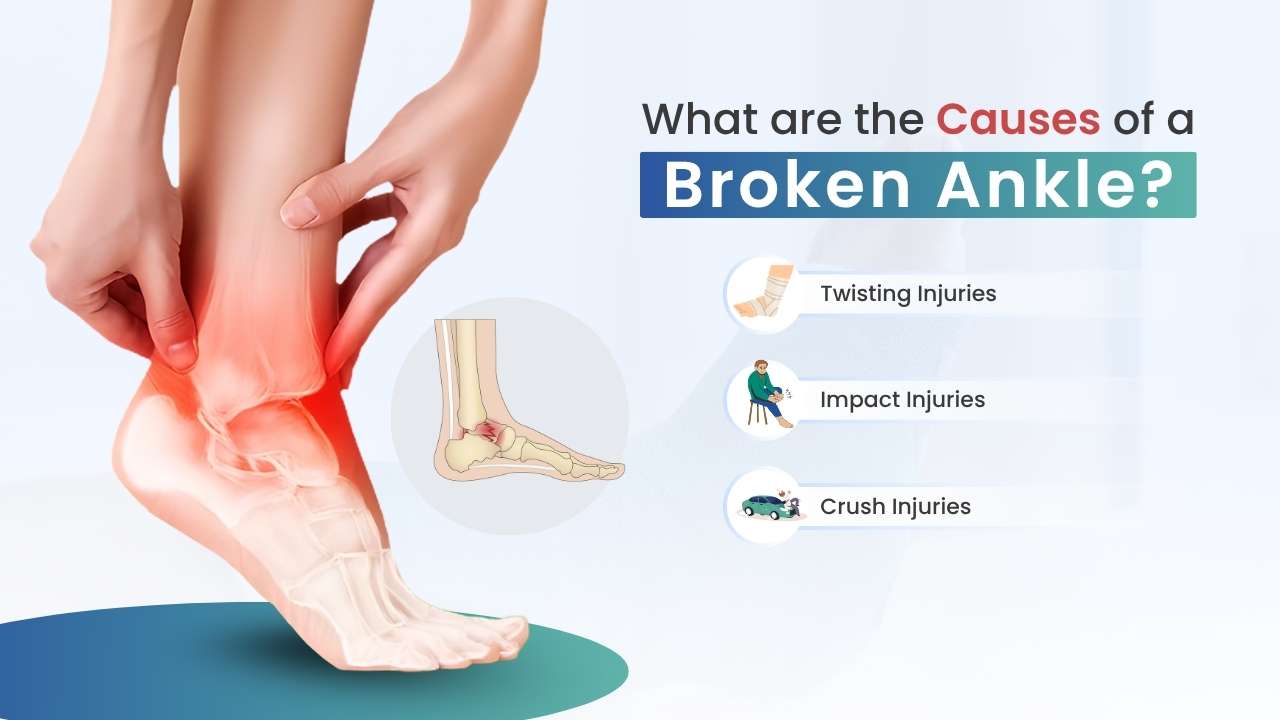 what are the cause of a broken ankle