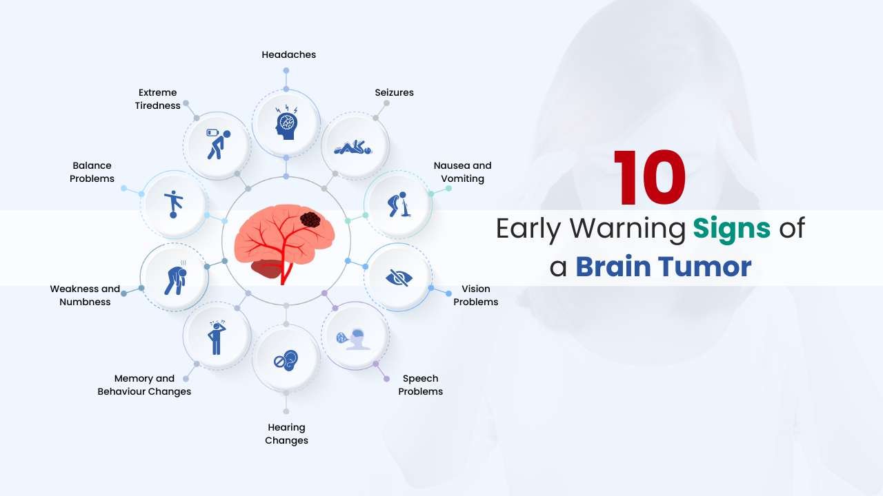 10 early sign of a brain tumor