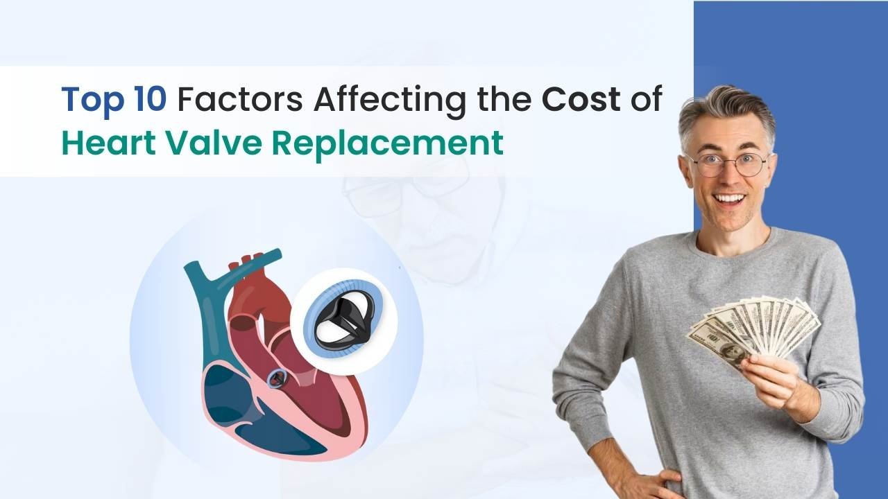Top 10 Factors Affecting the Cost of Heart Valve Replacement | Definitive Guide