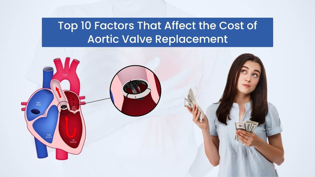 Top 10 Factors That Affect the Cost of Aortic Valve Replacement | A Definitive Guide
