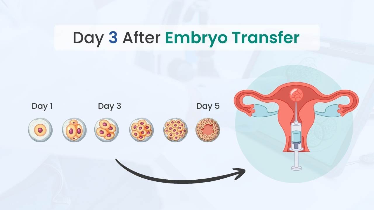 guide to ivf